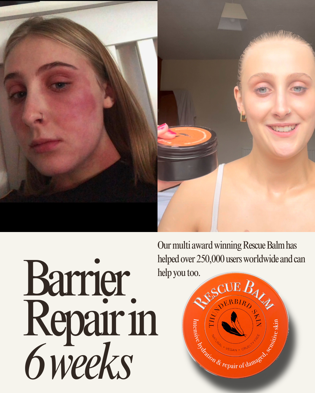 Rescue Balm