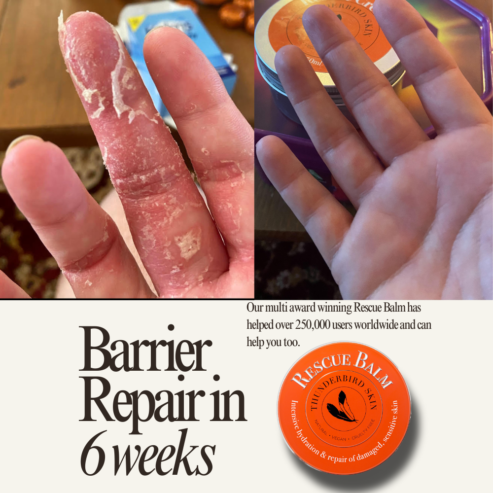 Rescue Balm