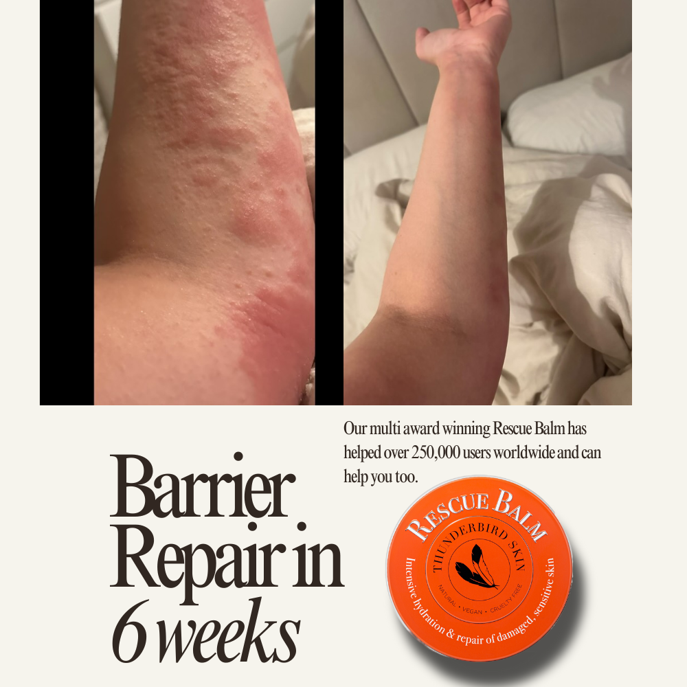Rescue Balm