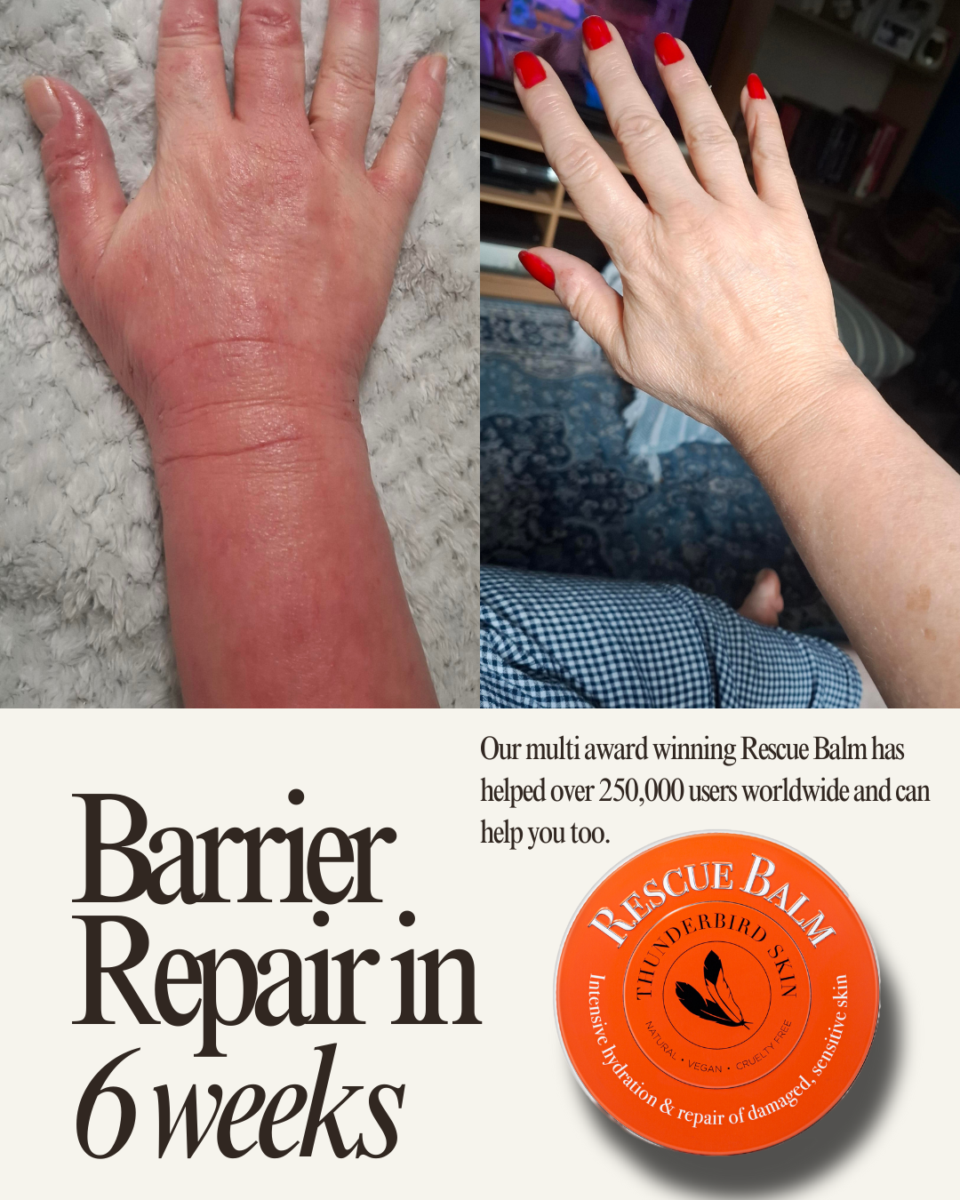 Rescue Balm
