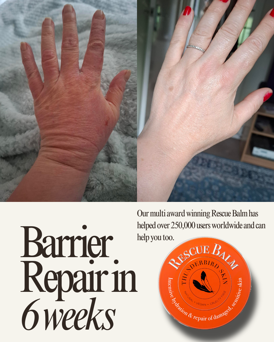 Rescue Balm