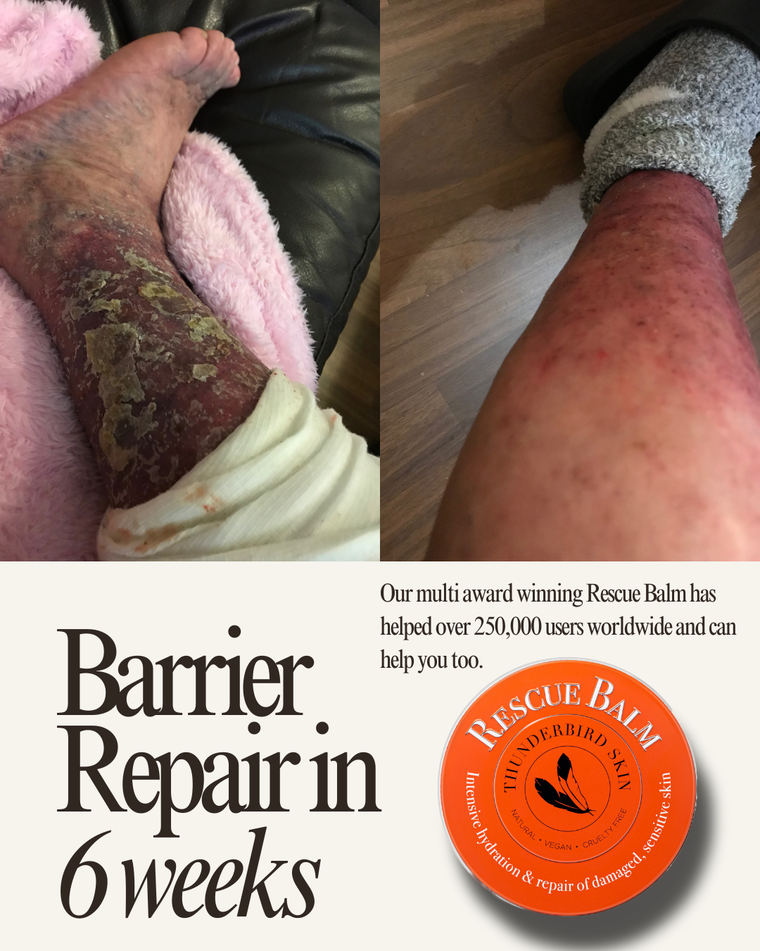 Rescue Balm