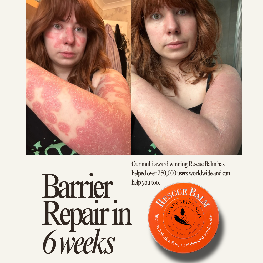 Rescue Balm
