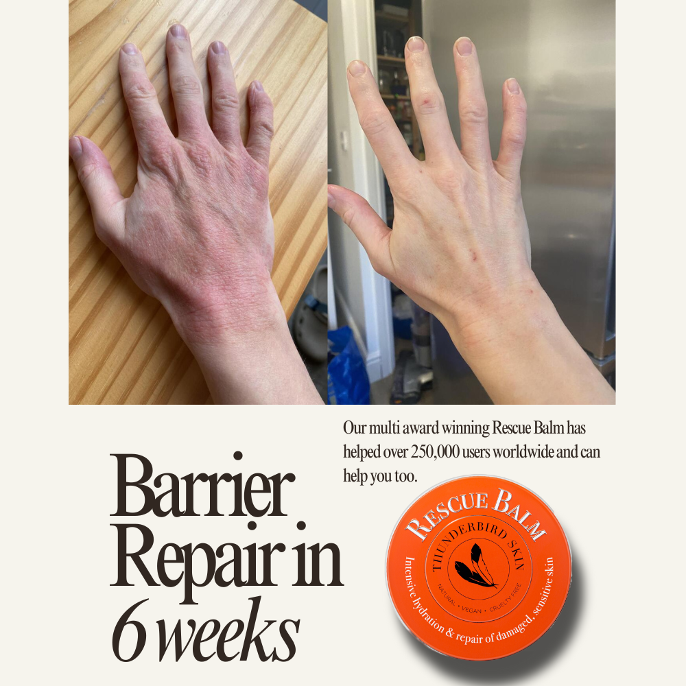 Rescue Balm
