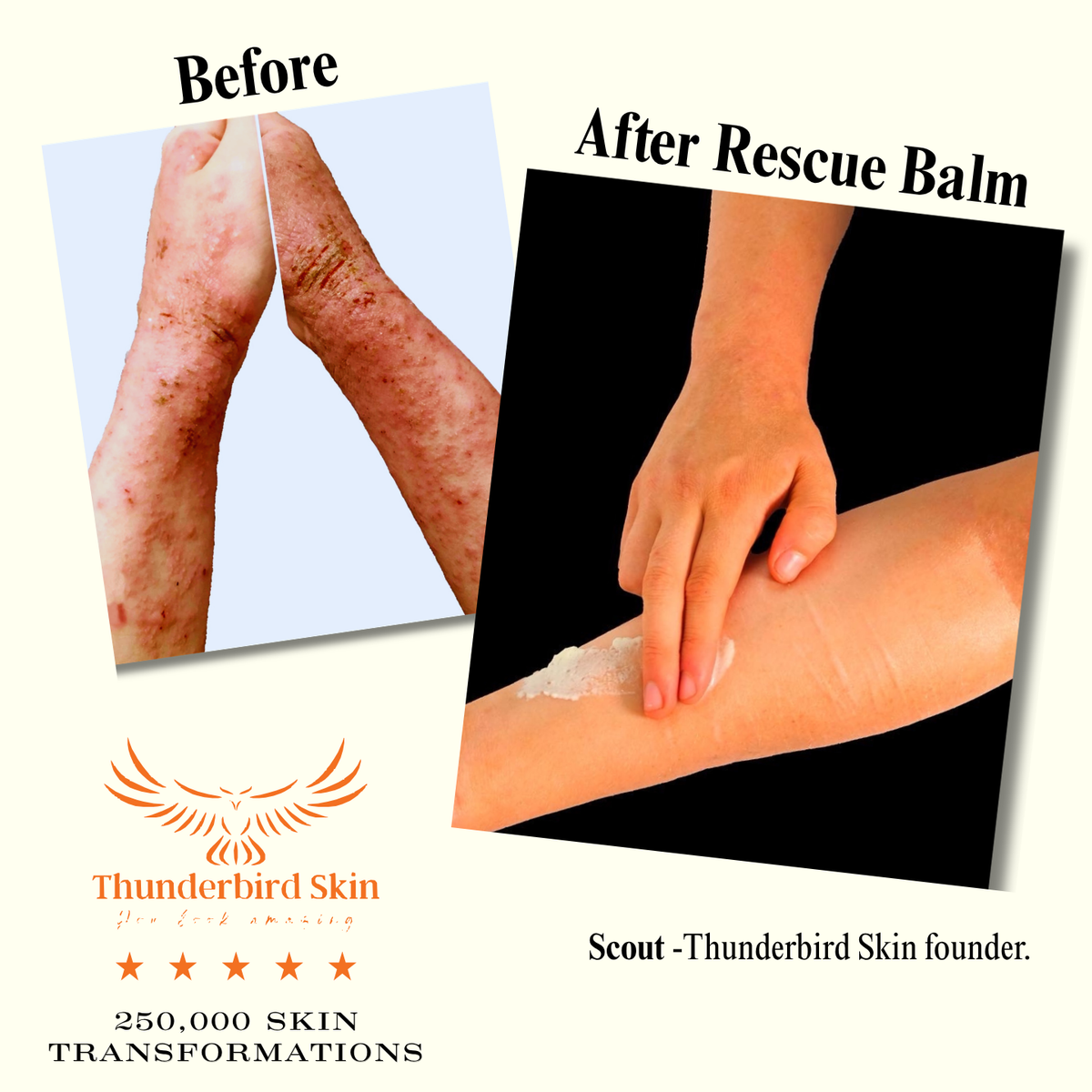 Rescue Balm