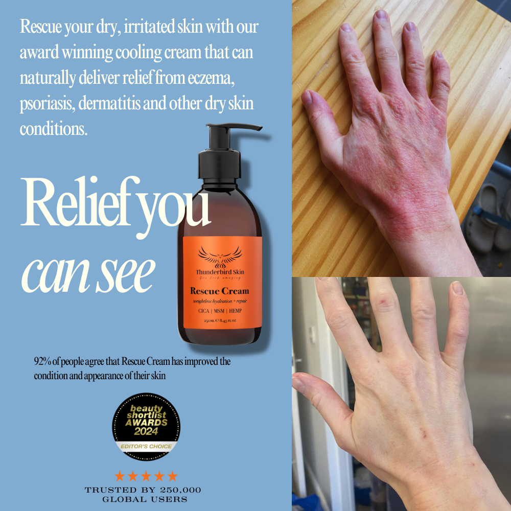 Rescue Cream