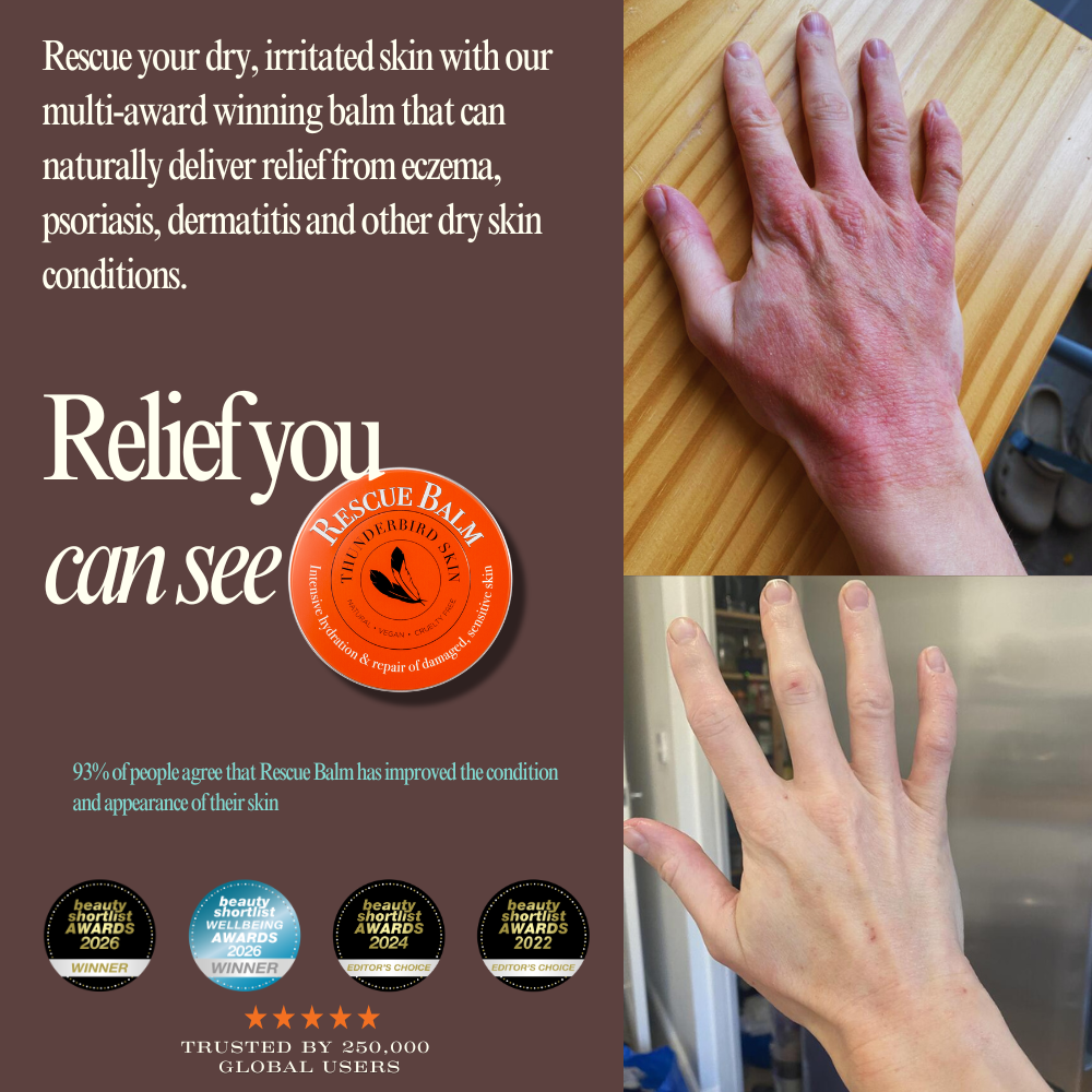 Rescue Balm