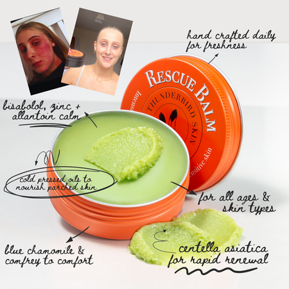 Rescue Balm