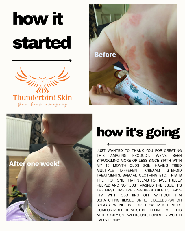 Thunderbird Skin Rescue Cream