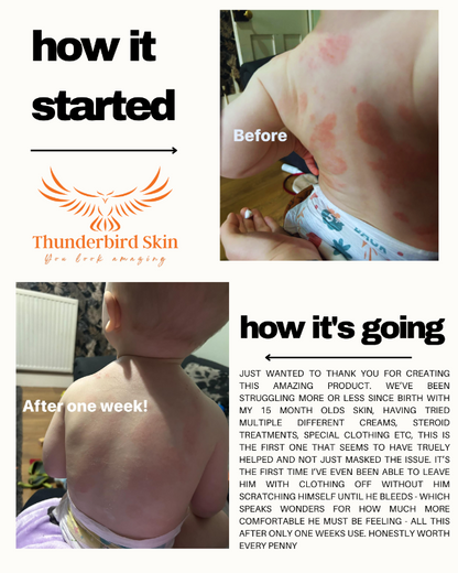 Thunderbird Skin Rescue Cream