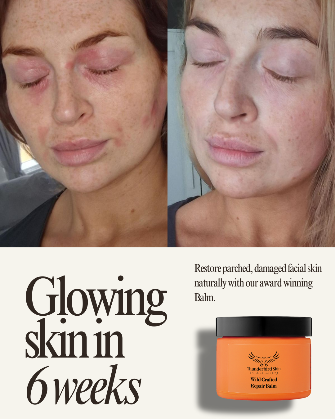 Wild Crafted Repair Balm