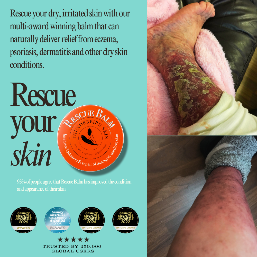 Rescue Balm