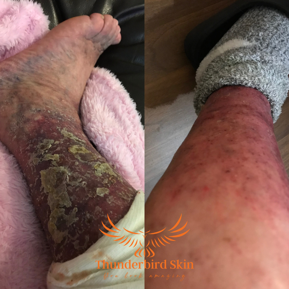 Rescue Balm
