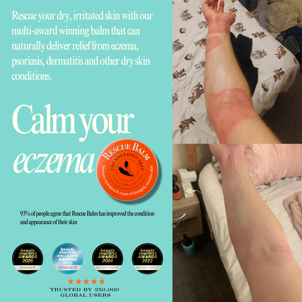 Rescue Balm