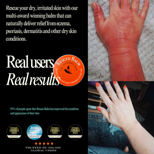 Rescue Balm
