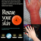 Promotional graphic for Rescue Balm with text on the left and two photos of a hand showing red, irritated skin on the right. The left side includes the Rescue Balm logo, award seals, and trust badge.