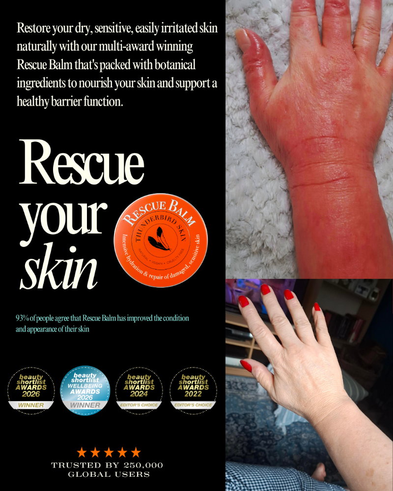 Promotional graphic for Rescue Balm with text on the left and two photos of a hand showing red, irritated skin on the right. The left side includes the Rescue Balm logo, award seals, and trust badge.
