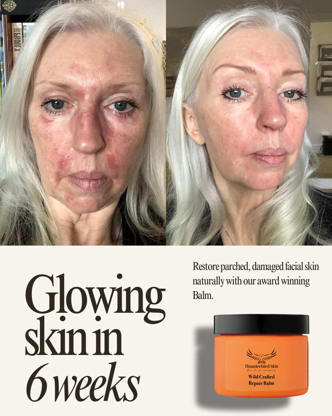 Wild Crafted Repair Balm