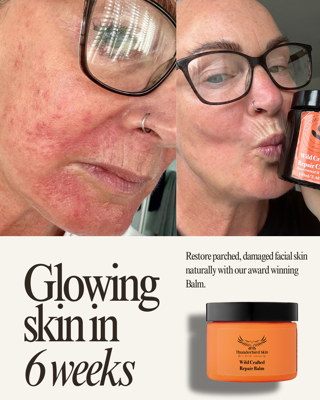 Wild Crafted Repair Balm