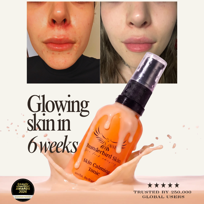 An orange bottle of Thunderbird Skin Skin Calming Tonic is shown with a glossy pink frothy splash at its base, set against a cream background with before-and-after skin close-ups and marketing text.