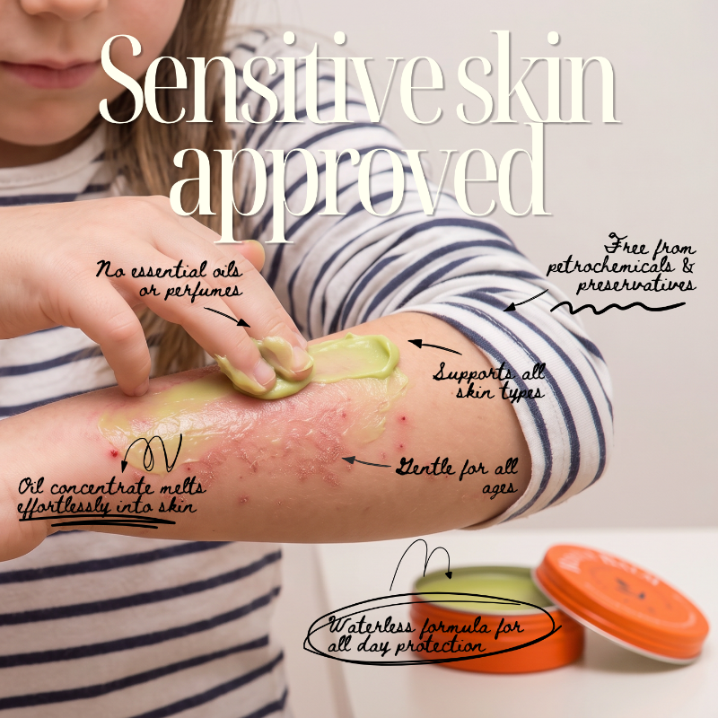 A child applies Rescue Balm onto an irritated arm. Large text reads 'Sensitive skin approved' with handwritten callouts about no essential oils, preservatives, and suitability for all skin types.