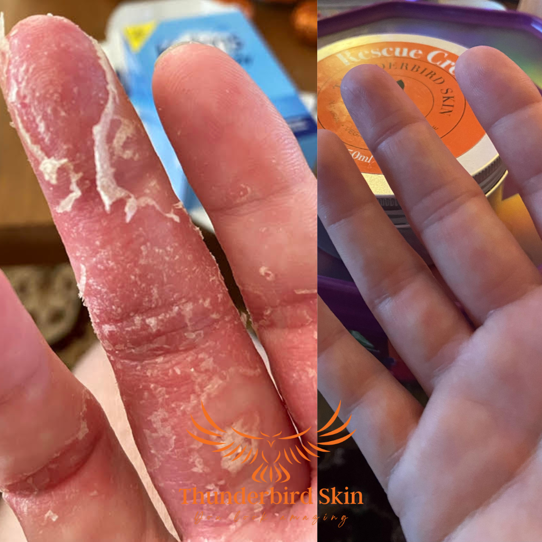 Rescue Balm