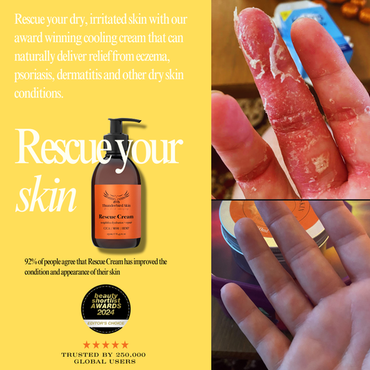 Rescue Cream