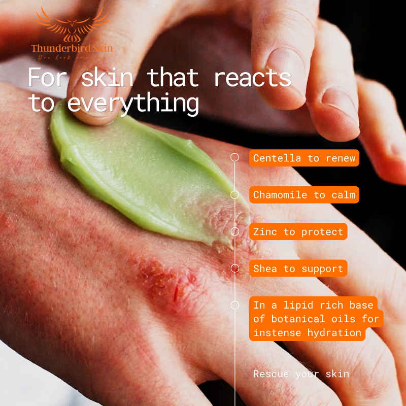 A close-up of a hand applying Rescue Balm to another hand showing skin irritation, with text overlays including 'For skin that reacts to everything' and product benefits. The brand name 'Thunderbird Skin' is visible in the top left corner.
