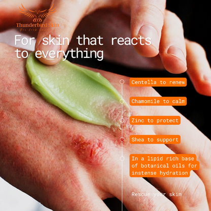 A close-up of a hand applying Rescue Balm to another hand showing skin irritation, with text overlays including 'For skin that reacts to everything' and product benefits. The brand name 'Thunderbird Skin' is visible in the top left corner.