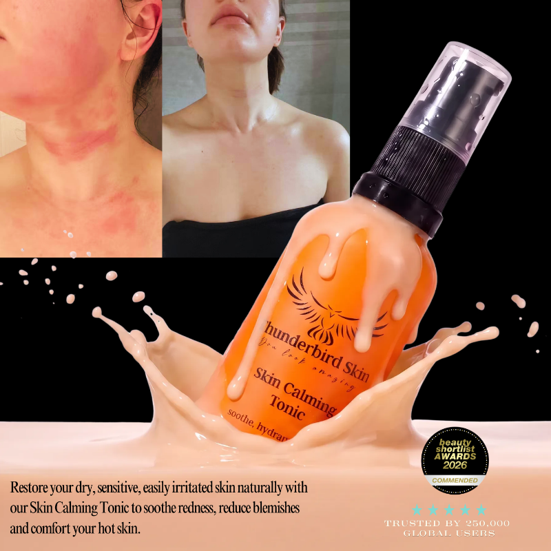 An orange bottle of Thunderbird Skin Skin Calming Tonic is shown with a milk splash effect and inset before-and-after skin photos. Text at the bottom describes skin relief benefits.