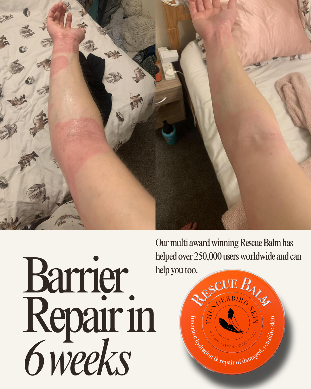 Rescue Balm