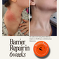 Rescue Balm