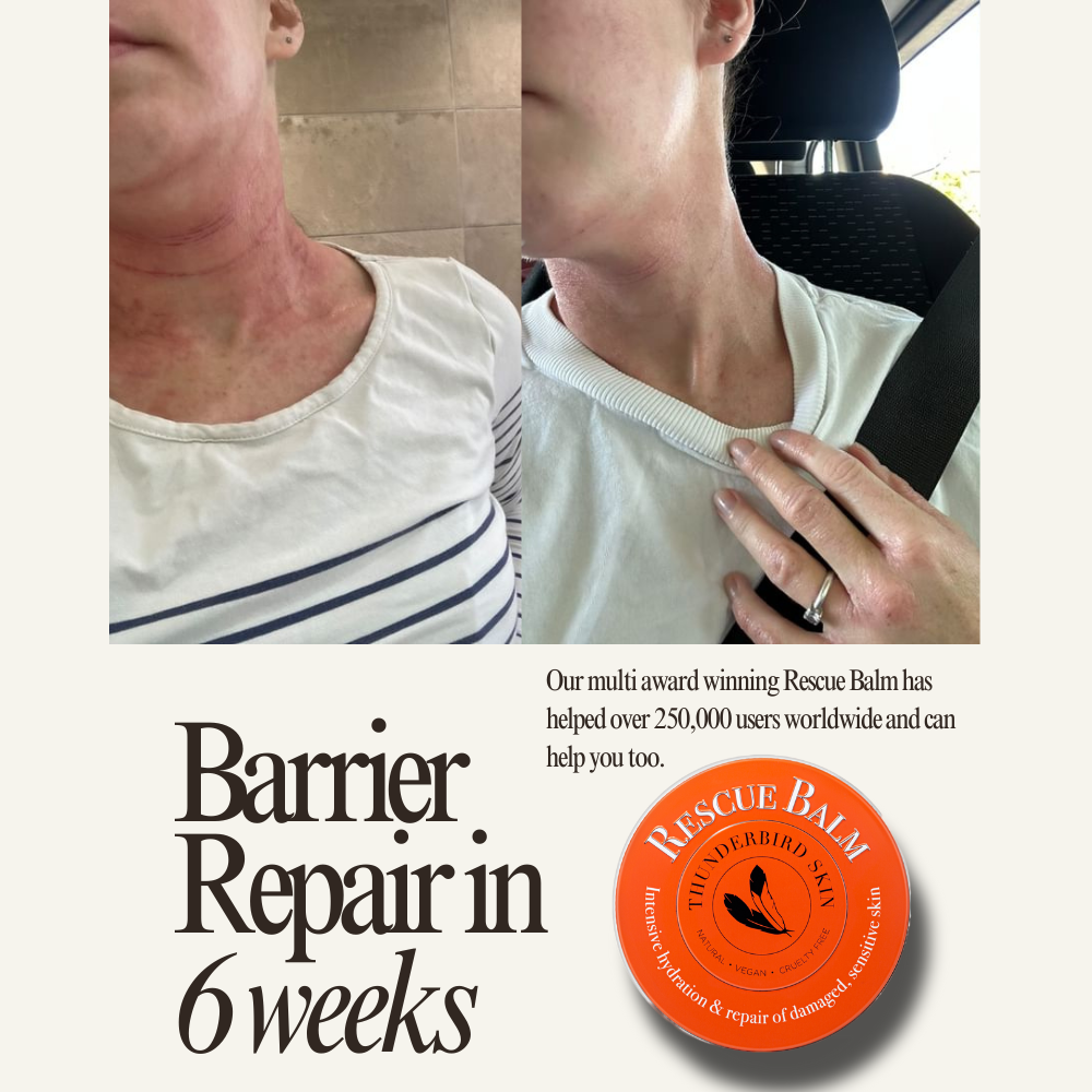 Rescue Balm