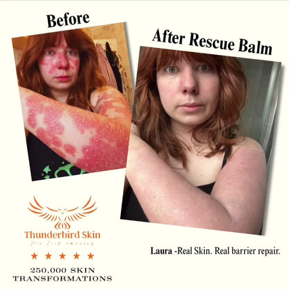 Rescue Balm