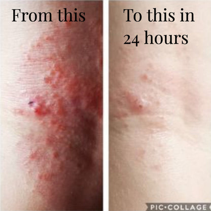 Thunderbird Skin Rescue Balm